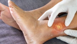 Foto 1 - Divulgação SES-TO