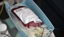 Bolsa de doação de sangue durante coleta Foto Heitor Iglesias (73)