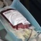 Bolsa de doação de sangue durante coleta Foto Heitor Iglesias (73)