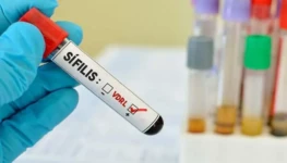 Teste-Sifilis