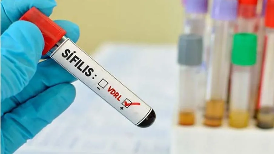 Teste-Sifilis